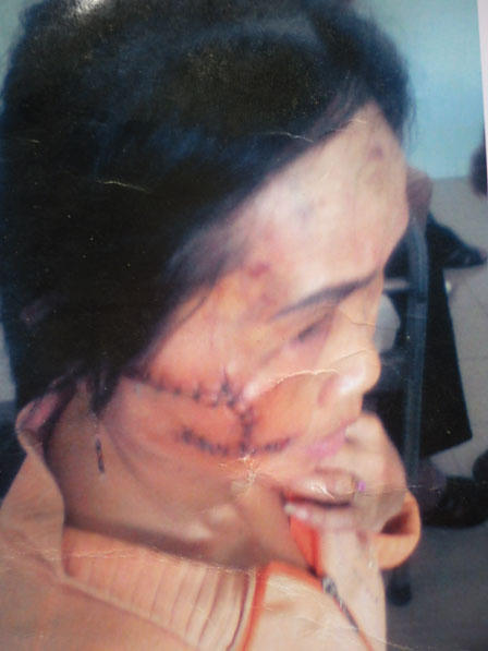 Bị đánh ghen oan, thiếu phụ nghèo kiện đòi công lý